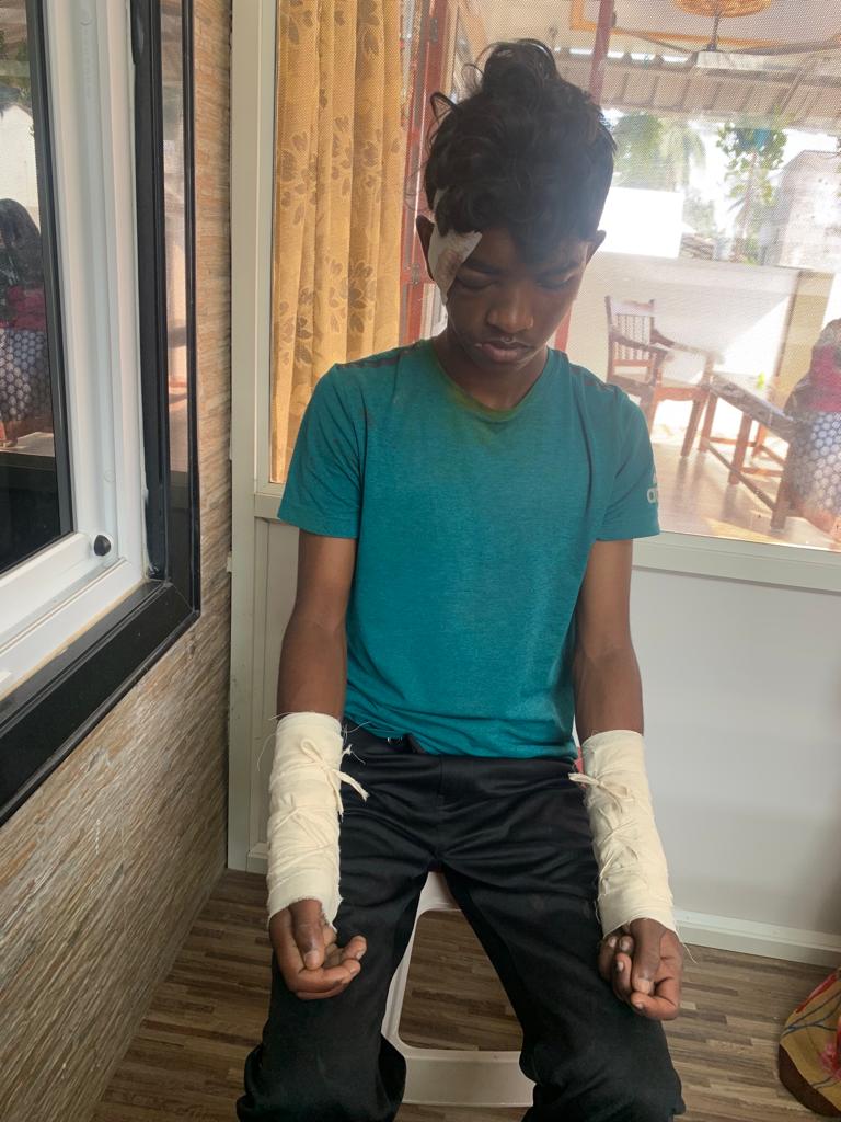 Bone fracture treatment procedure 3